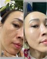 kem jukium Dòng kem trị nám hiệu quả nhất nhật bản. 