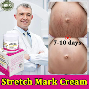 Stretch Mark Cream MamaS Choice Stretch Mark Cream pregnancy cream 150g Nourish Moisturizing Anti-Wrinkle Pregnant Women Skin Repair Remove Obesity Tattoo Care Firming Body Cream Stretch Mark Remover