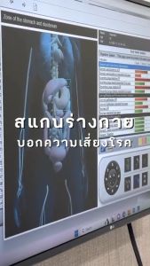 [E-Voucher] APEX สแกนร่างกาย EIS Bio Scan บอกความเสี่ยงโรคในอนาคต ของอวัยวะภายใน 37 อวัยวะ
