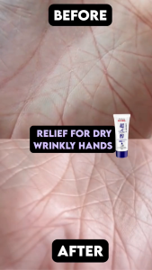Dr. Morita Retinol Repairing Hand Cream (70g) — Anti Aging & Fast Relief for Dry Cracked Hands