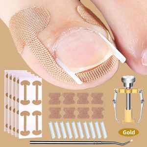Ingrown Toenail Corrector Isolating Spacer Pad