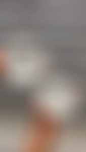 LED 5W/7W 3-color dimmable high-quality downlight ceiling light three-color pin-shaped light round panel light for Bedroom/Bathroom/Office decorative light for living rooms LED pin-shaped light