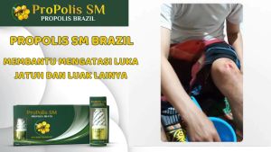 ProPolis SM 100% Asli Original Obat Penghilang Bekas Luka Koreng Obat Darah Manis Borok Cenang Bernanah