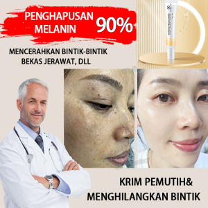 Krim Penghilang Flek 20g Hitam Melasma Anti-Freckle - Cream Pemutih-Wajah Glowing Nicotinamide