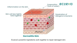 ECZEVA | Oral Solution Food Supplement Drink Powder Sachets 20 x 5g | Rice Ceramide Komecera Vitamin D3 Zinc | Halal | Age 3+
