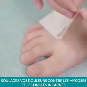 EELHOE Adhesive Ingrown Toenail Patch 50pcs Stiker Korektor Kuku Kaki Stiker Koreksi Kuku Peralatan Kuku Stiker Kuku Kaki