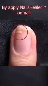 [ของแท้ 100%] เล็บสีเทารักษาของเหลว เล็บเชื้อรารักษาเชื้อรา เล็บเสียหายรักษาเชื้อรา เล็บสีเทารักษาเล็บ ต้านเชื้อแบคทีเรีย เล็บกลาก ต้านการติดเชื้อ