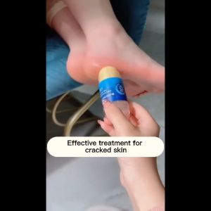 🔥Cadia👍 Original Vaseline Hands and Feet Chaps Cream Heel Anti-Chapping Moisturizing and Nourishing Stick Anti Crackling Vaseline Cream Calluses Remover Hydrating Drying Skin Care Hand Cream
