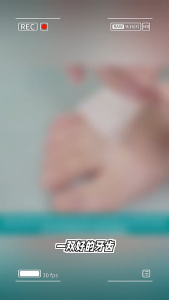 50Pcs Fungal Nail Patches / Sticker Kuku Cantengan / Sticker Koreksi Perawatan Kuku