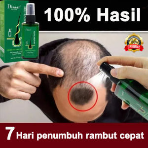 Serum Penumbuh Rambut 120ml Obat penumbuh rambut botak Serum penumbuh rambut botak Mengatasi botak serum penumbuh dan penebal rambut Pertumbuhan rambut menstabilkan akar rambut menutrisi secara mendalam
