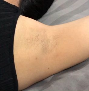 Organic Wax for Hair Removal | แว็กซ์กำจัดขน ขานก์แห้ง แว็กซ์ขนน้องสาว กำจัดขน ที่แว็กซ์ขน wax ชุมทิพย์ คล้องตัวเสริม แว๊กขนรักแร้