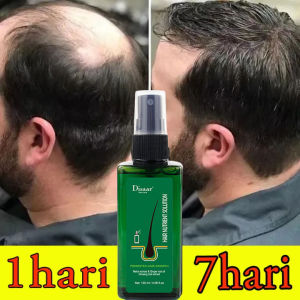 serum penumbuh rambut/growth spray - penumbuh rambut cepat serum penumbuh - obat penumbuh rambut botak - penumbuh rambut botak pria - hair tonic penumbuh rambut - perawatan rambut rontok Mempercepat pertumbuhan rambut 120ml