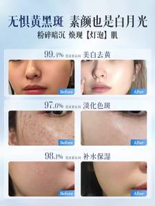 ORGINESE | Hydrating Brightening Dark Spots Reducing Face Mask