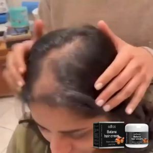 EELHOE Krim Rambut Batana Memperkuat Rambut Tebal Menutrisi Rambut Kering Merawat Kulit Kepala (100ml)