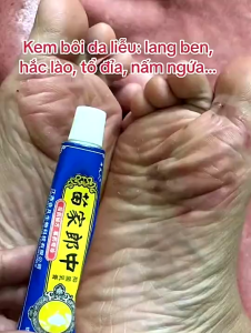 [Võ nhôm] Kem bôi Nẻ ngoài da á sừng nứt gót mẩn ngứa hắc lào vẩy nến nấm ngứa