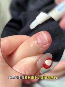 RUNBEN | Nail Cuticle Care Oil for Babies