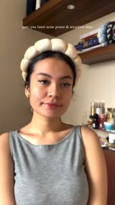 Skinmology By Benings Indonesia - 5 in 1 Acne Expert Series - Sabun Wajah Krim Siang Krim Malam Toner - Salicylic Acid Licorice Ceramide  - Menenangkan Kulit Berjerawat Kulit Kemerahan Melindungi Skin Barier - Pria Wanita Busui