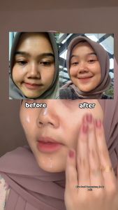 [𝐇𝐎𝐓 𝐒𝐀𝐋𝐄] Cleora 8x Hyalu Hydrating Moisturizer - Pelembab Muka Kering Dan Kusam Scincare Gel untuk Mencerahkan Kulit Dark Spot Whitening Mosturizer Skin Barrier Calming Brightening Skincare Wajah Facial Day Cream and Night Pria Dan Wanita