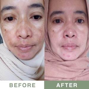 Amura Retinol Serum: Solusi Flek Hitam & Kerutan Wajah