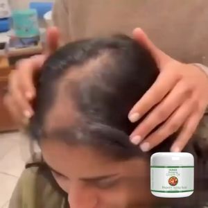 OUHOE Batana Hair Care Cream 100ml Repairs Dry And Damaged Hair Tail Deeply Moisturizes The Scalp