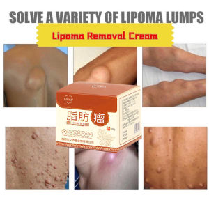 lipoma cream lipoma removal cream 30g Quickly remove fatty lumps Relieve fat tumor swelling pain repair subcutaneous fat Removing Multiple Single Lipoma Subcutaneous Lipoma Lump Bulge Lipoma Removal Patch 去粉瘤囊肿脂肪包块