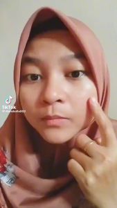 SR12 Penghilang Bopeng Revitalizing Serum Wajah Putih Glowing BPOM Pengecil Pori Pori Wajah