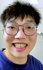 LYDIMOON Teeth Whitening Toothpaste Smoke stain removal  Remove tartar and clean yellow teeth toothpaste 100g/box Whitening toothpaste  fresh breath prevent odour Dissolves smoke stains