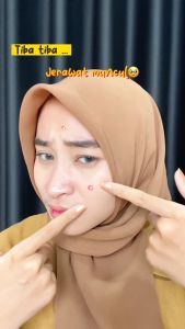 Berl Very Berry Acne Treatment Oil Control Serum - Penghilang Jerawat dan Bekas Jerawat - Mencerahkan