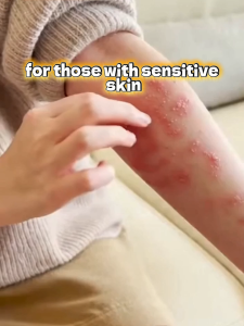 Japanese sulfur anti-itch cream 20g quickly relieves itching and redness. It is used to treat itching sweating herpes psoriasis and insect bites. Its herbal formula repairs the skin.