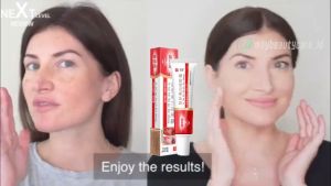 Cream penghilang flek hitam Bintik melasma flek hitam Melasma Cream