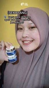 Fast Derm Paket Acne Whitening Platinum: Solusi Perawatan Jerawat Meradang