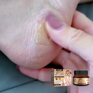 EELHOE Horse Oils Foot Cream Foot Hand Cream Hand And Foot Crack Prevention Repair Cream 30g