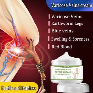 Varicose Veins Cream hilangkan urat bengkak urat angin urat timbul obat urat Varicose veins treatment baiki urat 静脉曲张治疗霜