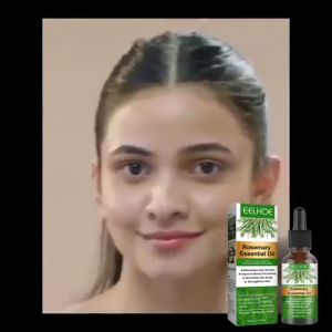 EELHOE Rosemary Hair Essential Oil Hair Growth Oil Hair Loss   Improves Bifurcation And Eliminates Itching 30ml
