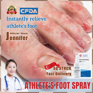 💥SG Stock💥 Athlete foot spray / Anti fungal foot cream / Foot odor remover spray / Foot deodorant spray / Foot peeling spray / Foot fungus spray / 腳氣噴劑