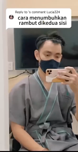 SWEETRIP Hair Growth Serum Penumbuh Rambut Wanita Pria Secara Cepat Obat Penumbuh Rambut Botak Mirip Red Ginseng Hair Tonic Minyak Kemiri 30ml PROMO TERMURAH PENUMBUH RAMBUT Cairan Essence Penumbuh Rambut Anti Rontok / Obat rambut botak