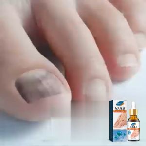 Essence Kuku Ximonth: Perbaikan Kuku Rusak & Pengobatan Onikomikosis