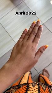 VITALINE SOFTGELS ORIGINAL TIENS - PEMUTIH KULIT SELURUH BADAN UNTUK LELAKI DAN WANITA PERMANENT - MOISTURIZING AND SOOTHING SKIN - JAGA KESIHATAN