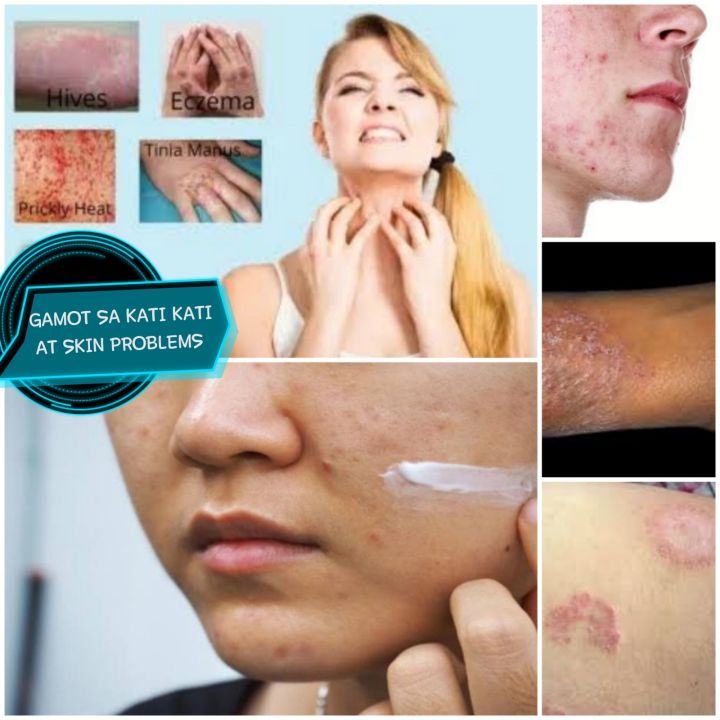 ORIGINAL CREAM FOR ALL SKIN PROBLEMS Lazada PH