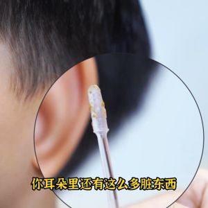 Sticky Ear Bar Ear Pick Artifact Sticky Cleaning Ear Bar Disposable Digging Ear Pick Self-Adhesive Ear Stick Cotton Swab
