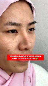 BPOM Glumevit Exfoliating Face & Body: Penghilang Daki & Mengangkat Sel Kulit Mati