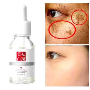 Bundara Ko-1552 Serum Bright & Glow Whitening Glowing Serum hapus Bintik-bintik 15ml fuyan