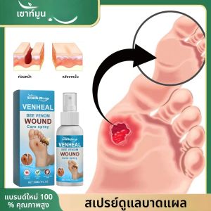 Bedsore Treatment สเปรย์ป้องกันการติดเชื้อรา Rapid Wound Healing บรรเทาความดันเจ็บปวดเบาหวาน Foot Care Liquid Band Aid