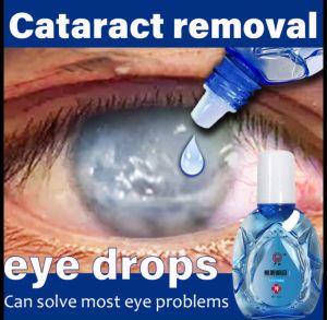 Eye Drop Cataract Eye Drops Bright Eye Drops Eye Washing Fluid For Eye Pain Blurred Eyes Eye Discomfort Red Eyes Itchy Eyes And Other Eye Problems Healthy 12ml