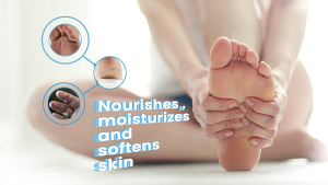 How to Treat Dry & Cracked Heels: The Ultimate Guide