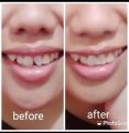 PROMO Temptooth temporary Tooth Buat Gigi Palsu Sendiri. 