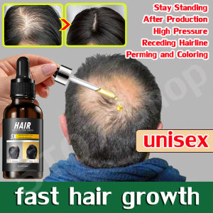Hair Growth Serum Anti hair loss serum 30ml Serum penumbuh rambut Anti Hair Loss Preventiom Scalp Treatment 生发液