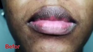 Lip Balm For Remove Dark Lip Melanin Dead Skin Removal Lighten Lip Lines Exfoliate Whitening Moisturizing Nourishing Serum