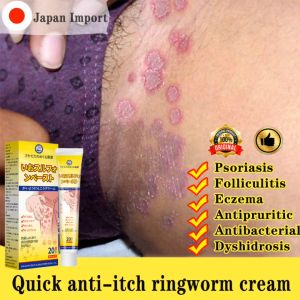 Obat gatal selangkangan Anti-itch cream Eczema Cream treatment Skin antifungal cream krim gatal kulit herbal psoriasis Skin itch for man and women