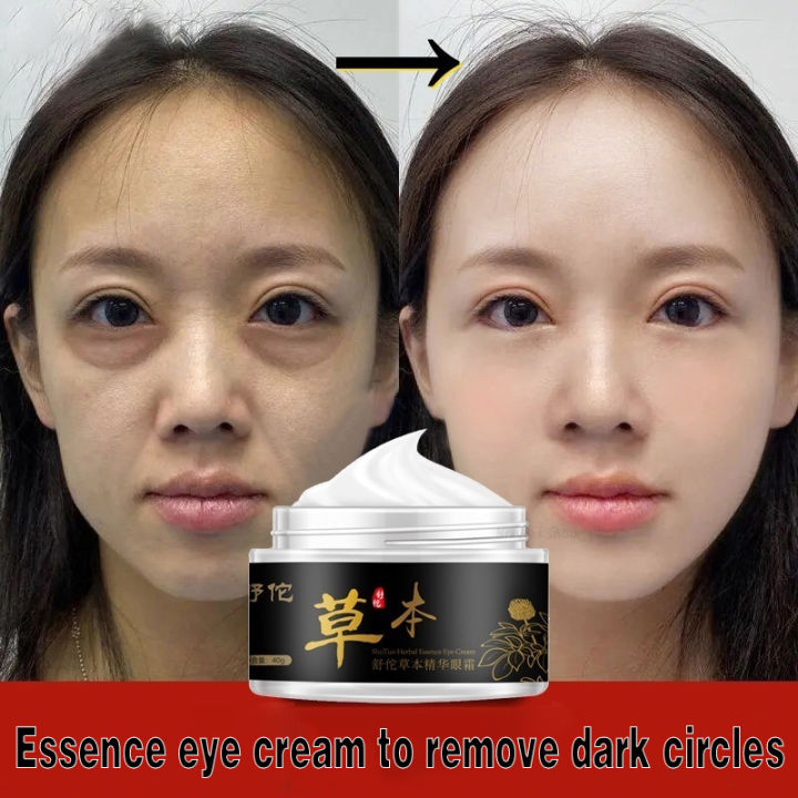 Fastacting Dark Circles Eye Cream Eye Bag Remover AntiAging Eye Cream